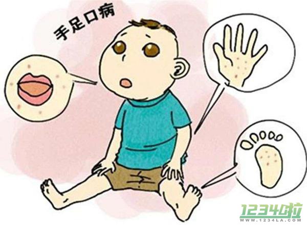 孩子患了手足口病后家长怎么护理